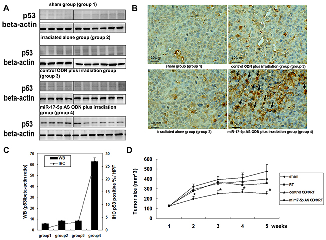 MiR-17-5p AS ODN therapy enhanced p53 expression and radiosensitivity of OC3 cell tumor growth in vivo.