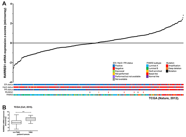 RARRES1 is highly expressed in triple-negative breast cancer.