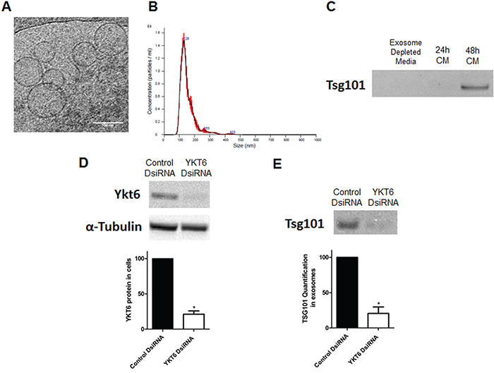 Exosome characterization, and YKT6 inhibition and effect on exosome release.