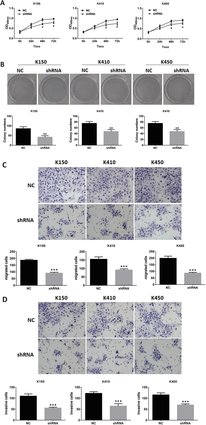 Silencing DNMT1 inhibited proliferation, metastasis and invasion in ESCC cells.