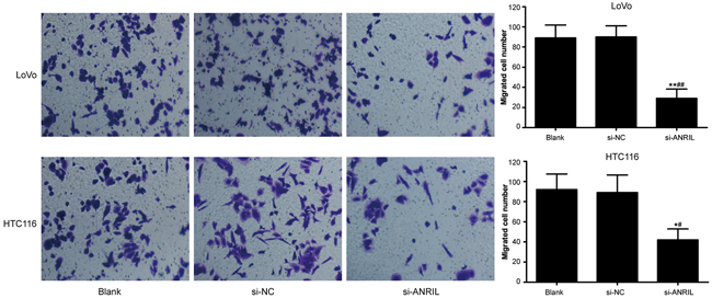 In-vitro invasion activity of LoVo cell line and HCT116 cell line detected by Transwell invasion assay after transfection with siRNA for ANRIL in si-ANRIL group, si-NC group and blank group.