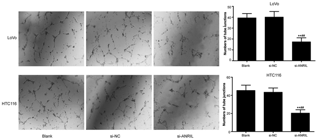 In-vitro ability of TNS-cultured HLECs in tube-formation after transfection with siRNA for ANRIL in si-RNA group, si-NC group and blank group.