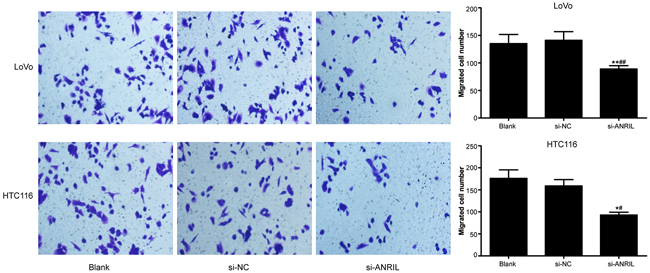 In-vitro cell migration of TNS-cultured HLECs detected by Transwell migration assay after transfection with siRNA for ANRIL in si-ANRIL group, si-NC group and blank group.