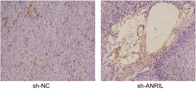 Stained lymphatic vessels of the transplantation tumors in the included mice with immunohistochemistry.