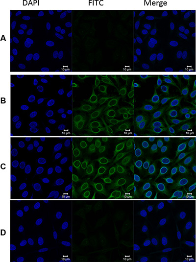 Representative immunofluorescence staining pattern of anti-RalA autoantibody in a positive PCa serum.