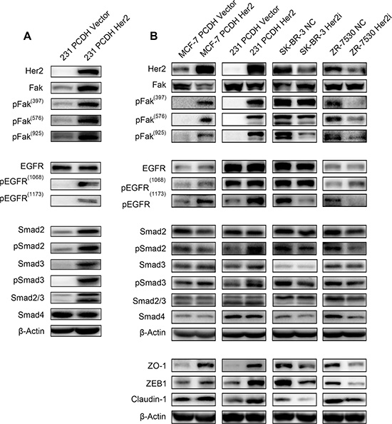 HER2 promotes Fak phosphorylation Immunoblot analysis of Fak and Fak-related molecules.