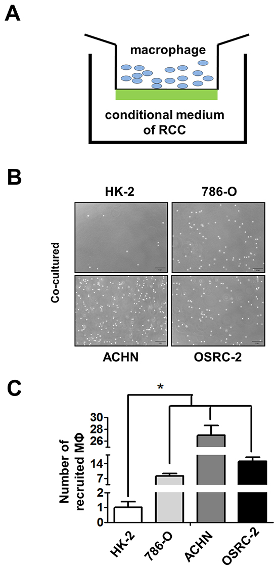 RCC cells have better capacity than normal renal epithelial cells to recruit macrophages.