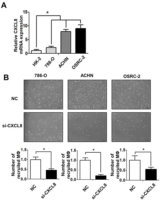 RCC cells recruit macrophages via secreting the CXCL8 cytokine.
