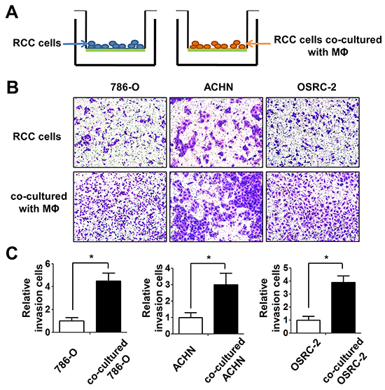 Infiltrating macrophage cells can increase the invasion ability of RCC cells.