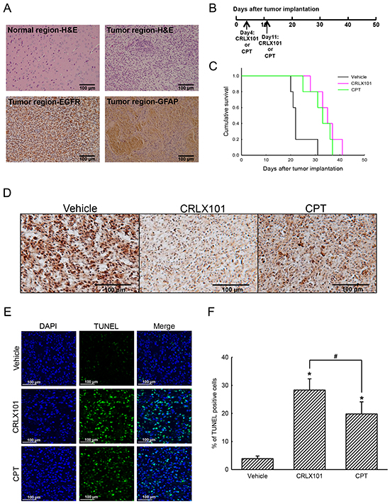 In vivo anticancer efficacy of CRLX101 against brain tumors.