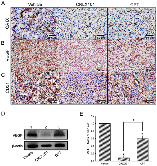 Antiangiogenic effect of CRLX101 in mice intracranial gliomas.