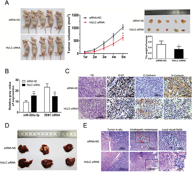 The impact of HULC on tumorigenesis and intrahepatic metastases in vivo.