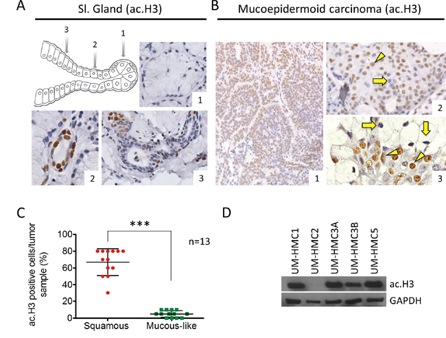 Levels of ac. Histone H3 in salivary glands and MEC.