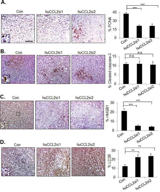 CCL2 gene silencing enhances necrosis and autophagy in MDA-MB-231 breast tumor xenografts.