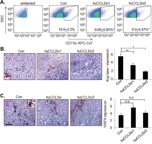 CCL2 gene silencing in MDA-MB-231 breast tumor xenografts inhibits M2 macrophage recruitment but not tumor angiogenesis.