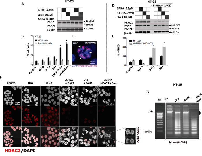HDAC2 controls the chromatin plasticity and its depletion enhances mitotic cell death in drug resistant HT-29 cells upon 5-FU and Oxa treatments.