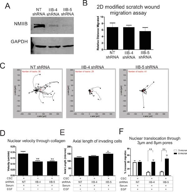 NMIIB is critical for enhanced motility of cancer stem cells.