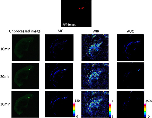 Unprocessed images and kinetic maps (MF, WIR, and AUC maps) using 10 &#x03BC;M gGlu-HMRG, and RFP image (the standard of reference for cancer location).