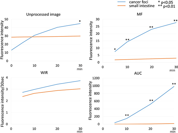 Time fluorescence intensity curve of the cancer foci and small intestine on unprocessed images, MF, WIR, and AUC maps using 5 &#x03BC;M gGlu-HMRG.