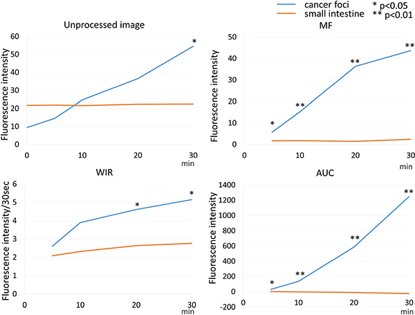 Time fluorescence intensity curve of the cancer foci and small intestine on unprocessed images, MF, WIR, and AUC maps using 10 &#x03BC;M gGlu-HMRG.