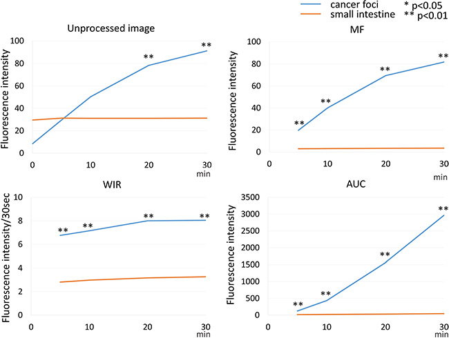 Time fluorescence intensity curve of the cancer foci and small intestine on unprocessed images, MF, WIR, and AUC maps using 20 &#x03BC;M gGlu-HMRG.