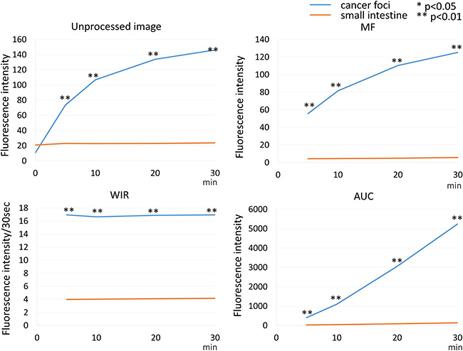 Time fluorescence intensity curve of the cancer foci and small intestine on unprocessed images, MF, WIR, and AUC maps using 100 &#x03BC;M gGlu-HMRG.