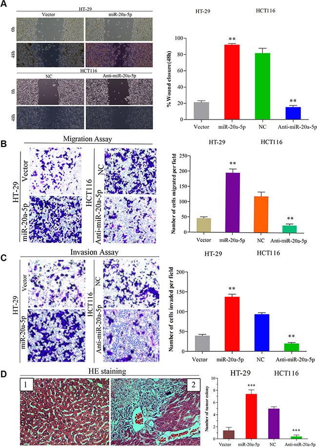Up-regulated miR-20a-5p promoted the invasion and metastasis of colorectal cancer in vitro and in vivo.