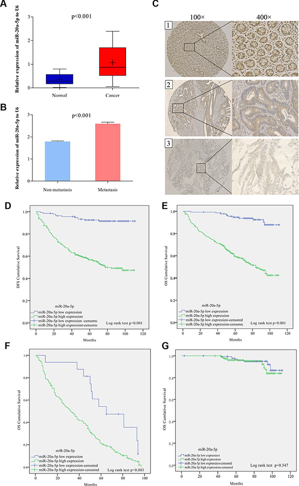 High level of miR-20a-5p was correlated with the metastasis and predicted poor prognosis in colorectal cancer patients.