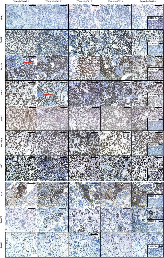 IHC staining of indicated proteins in TCam-2-&#x2206;SOX2 clones.