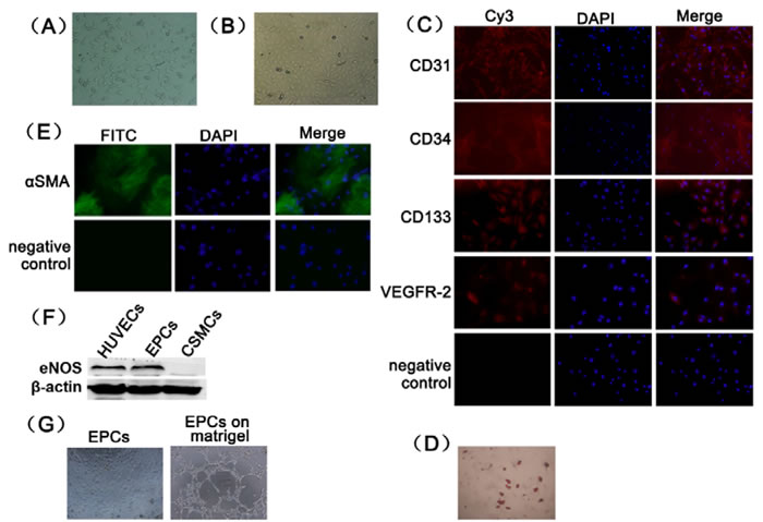 Primary culture and characterization of rat EPCs.