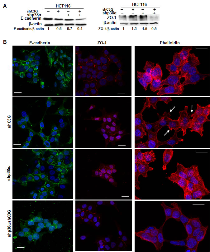 Effect of C3G knock-down on actin-organization, E-cadherin and ZO-1 expression and their subcellular localization in HCT116 cells.