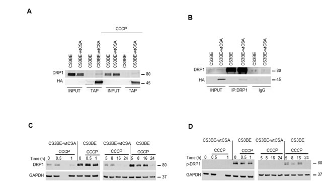 DRP1 interacts with CSA and is hyperactivated in CS-A cells.