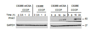 PINK is stabilized in CS-A cells under CCCP exposure.