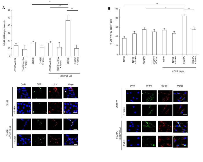 Parkin overexpression ameliorates the clearance of damaged mitochondria in CS-A cells.