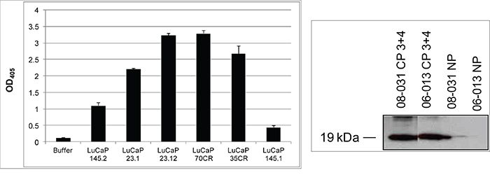 AGR2 levels in tissue digestion media.