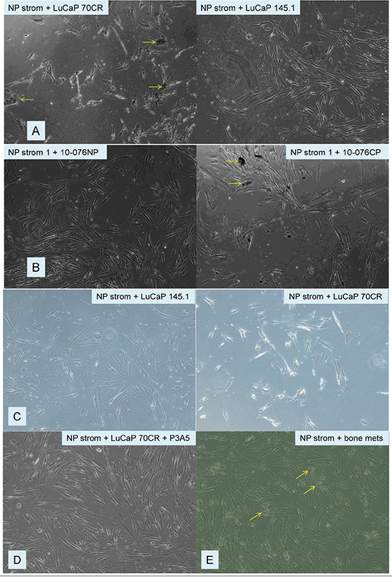 Effect of AGR2-containing media on NP strom cells.