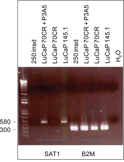 Differential expression of SAT1.