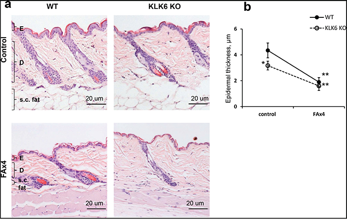 Glucocorticoid-induced skin atrophy in wild type (WT) and KLK6 KO mice.
