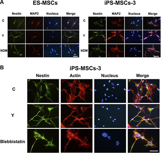 PSC-MSCs express early neural markes after RhoA kinase (ROCK) inhibition.