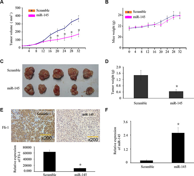 miR-145 suppresses OS xenograft tumor growth and FLI-1 expression in vivo.