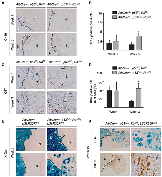 Loss of p53 and Rb leads to enhanced proliferation cholangiocytes within the RFA site.