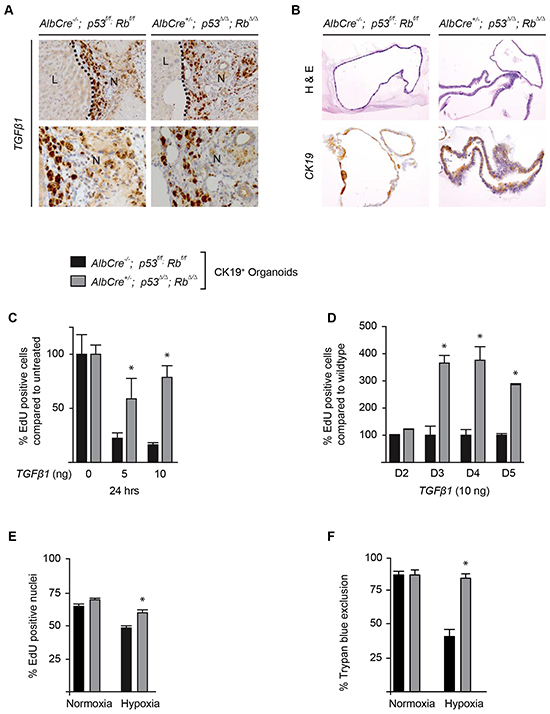 p53 and Rb deficient bile ducts are resistant to proliferation inhibitory signals induced by TGF&#x03B2;1 and hypoxia.