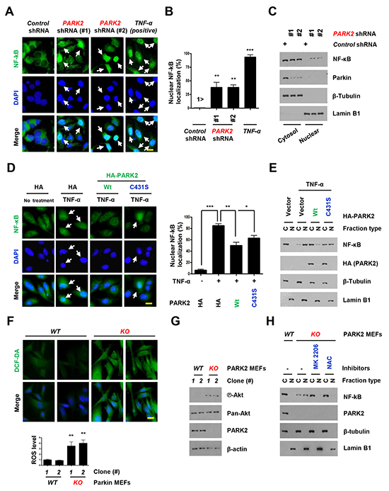 Overexpression of PARK2 inhibits localization of the nuclear NF-&#x03BA;B for inflammation.