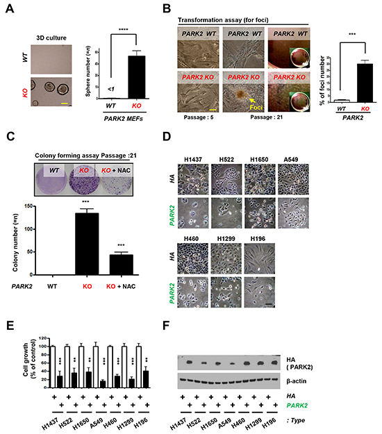 PARK2 loss leads to tumor initiation and overexpression of PARK2 inhibits cell proliferation in lung cancer cell lines.