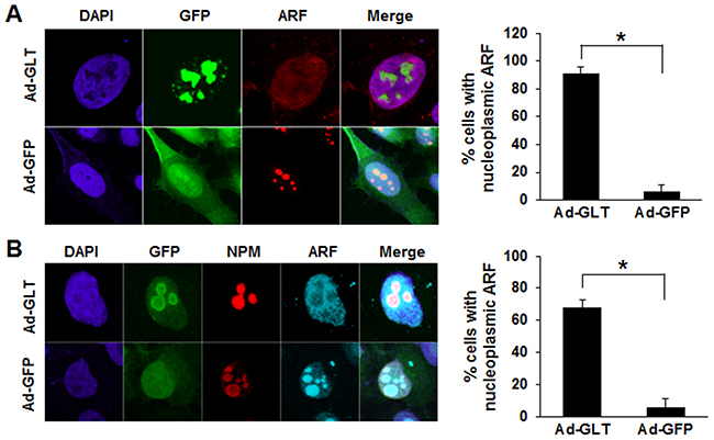 GLTSCR2-induced nucleoplasmic redistribution of ARF.