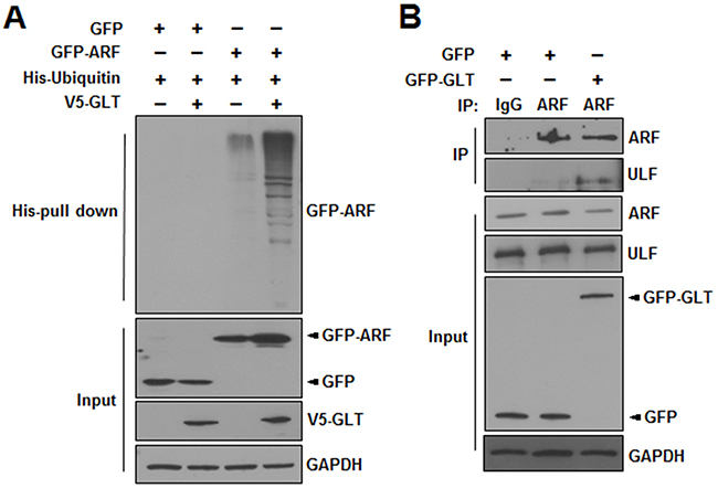 GLTSCR2 enhanced the polyubiquitination of ARF.