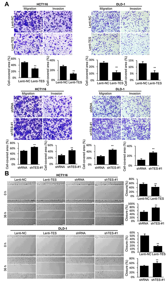 TES suppresses migration and invasion in CRC cells.