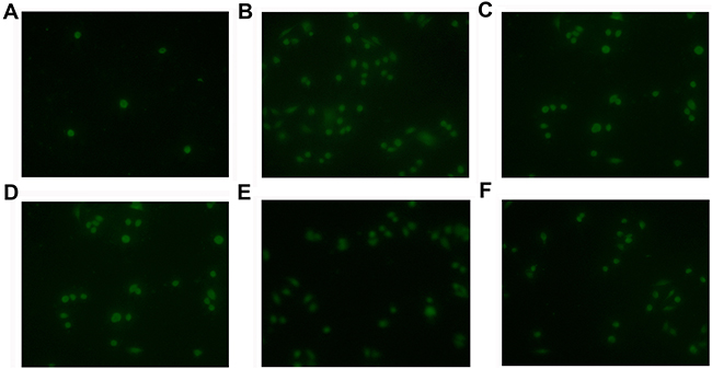 NNMT attenuates the 5-FU-induced apoptosis via 1-MNA in vivo.