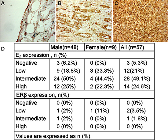 E2 expression by immunohistochemistry in normal pleural and MPM.