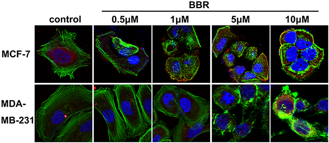 Berberine inhibits the formation of F-actin.